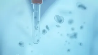 Cyclosporiasis-Alarm: Neue PCR-Tests treiben Fallzahlen in die Höhe