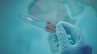 Ebola-Ausbruch im Kongo: Fokus auf globale Reaktionsmechanismen und diagnostische Prozesse