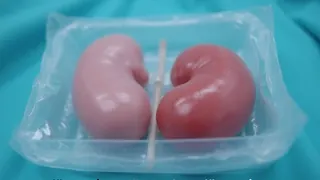 Xenotransplantation: Schweineniere überbrückt Wartezeit auf menschliches Organ